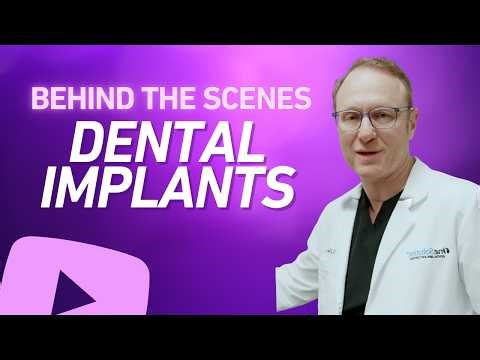 What Happens Behind the Scenes After You Decide on Full Arch Implants