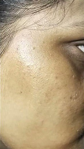 Moisturizer I'm using | Keevlogs | Skincare | Ponds