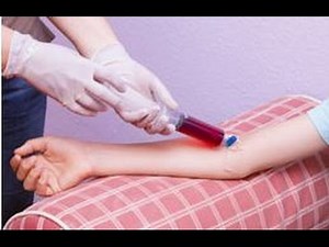 D-Dimer Levels in Pregnancy