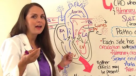 Transposition of the Great Arteries NCLEX Review