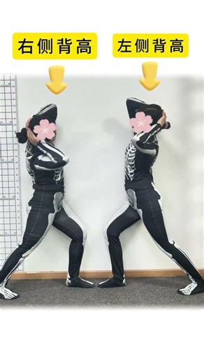 Easy Razor Back Exercises for Scoliosis Correction