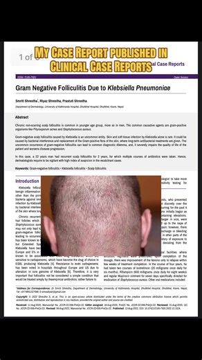 Throwback to My 2022 Case Report Publication