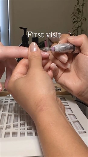 Healthy Natural Nails | Ipswich 🇦🇺 Mako on Instagram: "Bitten nail transformation 👉️@the_nail_hub_mako Why don’t bitten nails grow? When the nail is cut or bitten below the skin line, the raised skin can block healthy growth. When nails are too short, the cuticle may overgrow to “protect” them making the nail thinner and easier to bite again. Builder gel alone won’t fix it. Healthy nail growth takes proper knowledge and care. ✼•┈┈┈┈┈┈┈┈┈┈┈┈┈┈┈┈┈┈•✼⠀ The NaiL Hub⠀ 🏡 Home-based salon in Ipswic