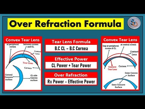 Over Refraction Calculation in just 3 Simple Steps.
