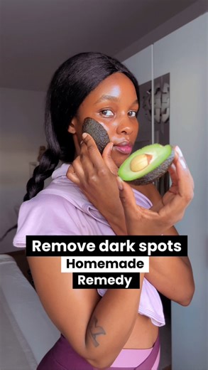 Remove dark spots naturally at home. All organic and good for all skin types. #darkspots #removedarkspots #skincare #fypシ゚ #organicskincare #fypviralシ #viralreelsシ #reelsviral #skincaretips #naturalskincare #howto #viralreelsfb #fb #goviral #trendingreels | Aroma Talks
