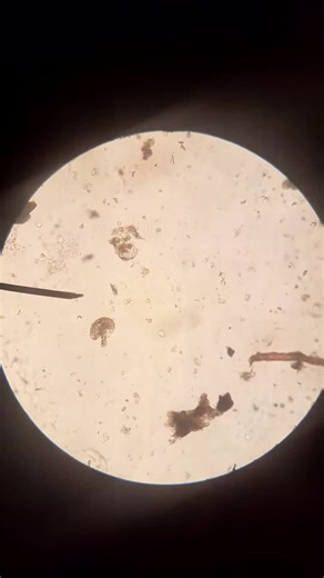 File:Tardigrade under a microscope, from a Scottish high school playing field.webm - Wikimedia Commons