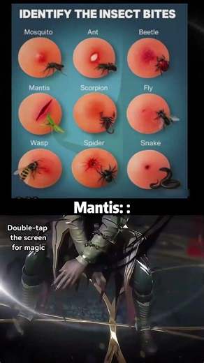 If Insect Bites Were as Bad as This