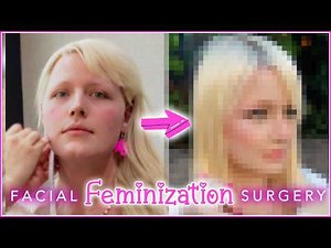 Face Reveal - I Got Facial Feminization Surgery!
