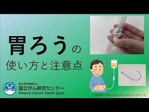 胃ろうの使い方と注意点【国立がん研究センター 東病院】