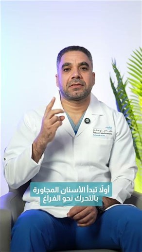 Lost a Tooth? Why You Shouldn’t Ignore It | Dental Implants Explained | Dr. Hassane Ayoub, Dentist