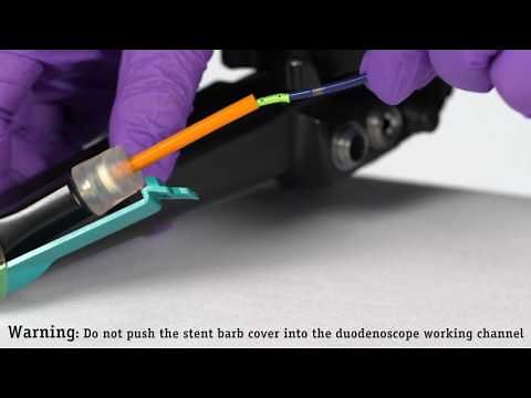 Advanix™ Pancreatic Stent Device Placement Using NaviFlex™ RX Delivery System