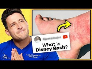The Truth Behind the “Disney Rash” Explained | Viral Theme Park Skin Reaction | RTC 38