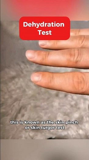 do this to check your body's dehydration level