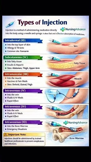 Type of injections | how to inject injections | konsa injections kis trah lgaya jata h |
