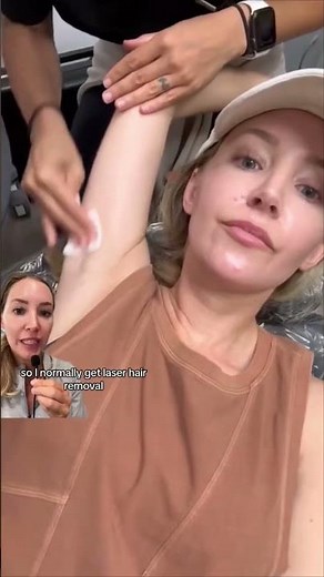 Laser Hair Removal Alpha VS Splendor X