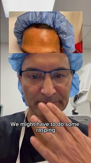 HUGE OSTEOMA REMOVAL - DR. TANVEER JANJUA - NEW JERSEY