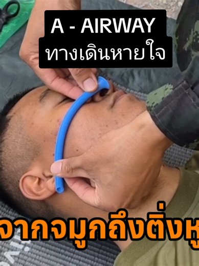 A-airway หลักการเปิดทางเดินหายใจ -ถามตอบได้ = ปลอดภัย -ถ้าไม่ได้ ให้ตะแคงหน้า จัดท่าพักฟื้น การเปิดทางเดินหายใจด้วย NPA -จัดท่าผู้ป่วย เชิดคางขึ้น -วัดจากจมูกถึงติ่งหู -แกะซอง ใส่เจลหล่อลื่น(น้ำ,เลือด) -ข้อห้าม เมื่อใบหน้าเละ ห้ามใส่ เพราะจะทำให้เลือดไหลไปอุดตันที่หลอดลม #tccc #medical #การปฐมพยาบาล #ทหาร #ชายแดนไทยกัมพูชา