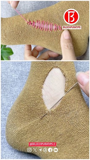 Using a needle and thread, neatly mend a torn sock hole Part 2288 Follow My Page Instagram : @bilochpuratips2diy Follow My Page Instagram : @bilochpuratips2diy . . . . . . #bilochpuratips2diy #bilochpuratips #needlework #sewing #reels . | Bilochpuratips 2 Diy