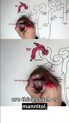 💊Diuretics in Action! See how they drop high blood pressure! #diuretics #meded #clinicalpharmacology
