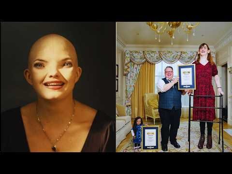 15 Bizarre People With Unbelievable Stories!