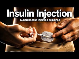 The Complete Guide to Sub-Q / Insulin Shots: Sites, Math, and Technique