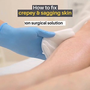 174K views · 790 reactions | The #1 treatment for repairing crepey skin on the neck, chest, arms, and legs! Click for our exclusive 35% OFF offer! | City Beauty | Facebook