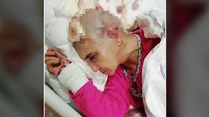 ​Antalya'da köpek dehşeti: Kafa derisi koptu | 3. Sayfa Haberleri