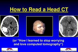 How to Read a Head CT - SlideServe