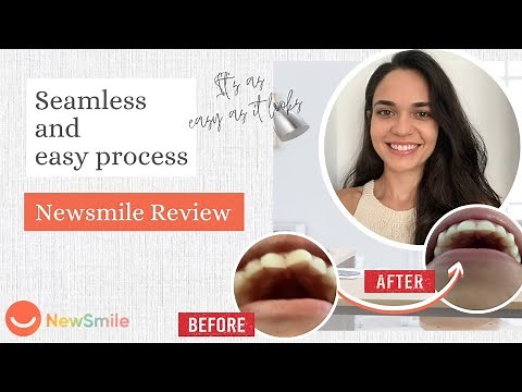 Easy Way To Straighten Teeth With NewSmile Invisible Aligners | Honest Review