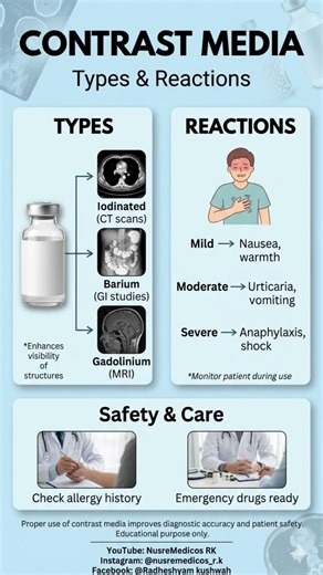 Contrast media #ContrastMedia #Radiology #CTScan