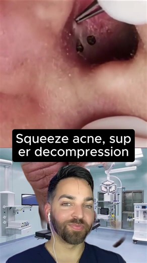 Effective Techniques for Pimple and Blackhead Removal