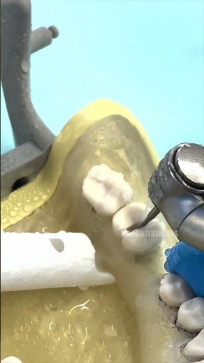 How The Dentist Extracts a Tooth