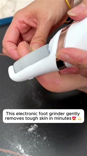 Electric Foot Grinder!🌟💫 #foot #footcare #nailart