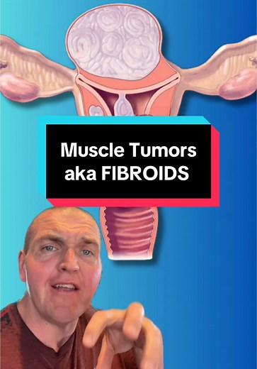 Understanding Uterine Fibroids: Causes and Symptoms