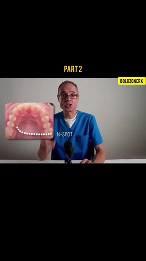 How to Change YOUR FACE Shape Naturally Mewing Technique Explained mewing tutorial mewin kaise karen mewing for jawline Mewing before and after Mewing transformation #mewing #dentist #orthodontist #beauty #jawline