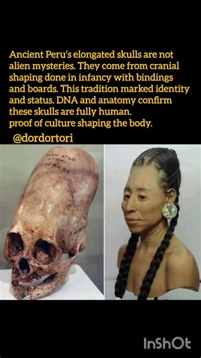 Alien Skulls? The Real Answer Will Surprise You, #history #facts #historyfacts #shorts