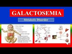 GALACTOSEMIA - Definition, types, causes, pathophysiology, symptoms , diagnoses , medicine