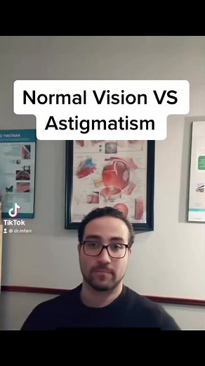 Do You Have Astigmatism? #eyes #eye #optical #doctor #optometrist #optometry #cool #funny #eyedoctor #ophthalmologist #glasses #vision #astigmatism #myopia #hyperopia
