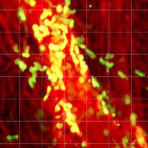 Video: Mouse Heterotopic Cervical Cardiac Transplantation Utilizing Vascular Cuffs