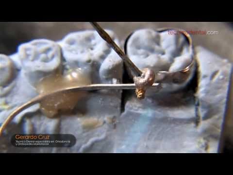 How to optimally solder orthodontic appliances.