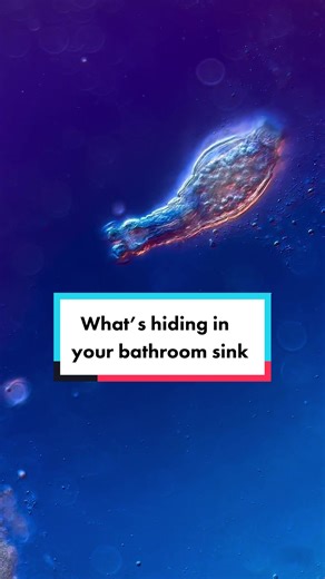 I thought you might want to know 👀 I even found tiny amoebae! Don’t freak out just yet though, these organisms aren’t dangerous for us at all. In fact, they eat bacteria and fungi from your sink! And when they die, bacteria eats them. Just don’t go and eat that black sink crust alright? 🥲 Rotifers and nematodes are virtually everywhere; in soils, freshwater, marine water, mosses, lichens, in your sinks and some even chill in your washing machine filter 😱 Along with tardigrades, rotifers and n