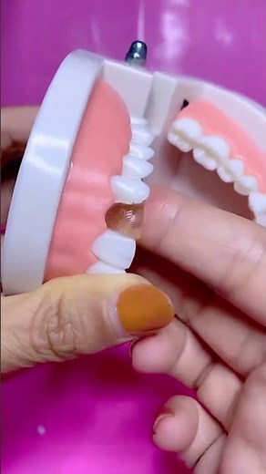 Having take care of your tooth and fix and build a self fake tooth #filling #🦷#hole#repair