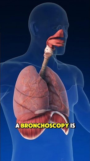 What Happens During a Lung Bronchoscopy?