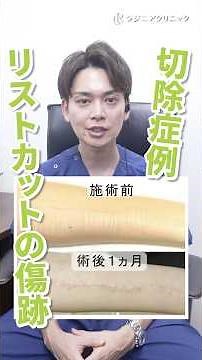 タトゥー切除のリアル解説｜首と胸の症例・レーザーとの違い・傷跡ケアまで