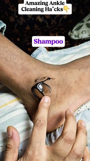 1.2M views · 2.4K reactions | Amazing Ankle Whitening Ha*cks at home! #fblifestyle #anklecleaning #darkspot #removedarkspot #skincare #homeremedies #beautytips @top fans | Mind power | Facebook