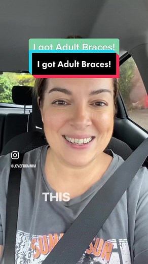 What it’s like to get adult braces in my 40s! Eek it’s the start of a long braces journey but I’m excited for the results! 🦷 😬 STAY TUNED for the full journey! #adultbraces #adultbracesclub #adultbracescheck #adultbracesgang #adultbracesover40 #adultbracesjourney #adultbraced
