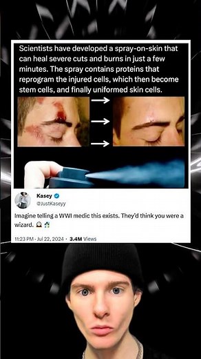 Scientists have developed a spray-on-skin that can heal