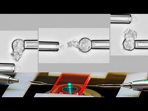 Chemotaxis of human neutrophils to Coccidioides endospores
