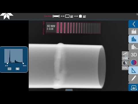 GO-SCAN 1510 - Digital Portable X-Ray system