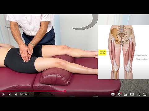 Femoral Focus: One-Minute Rectus Femoris Palpation